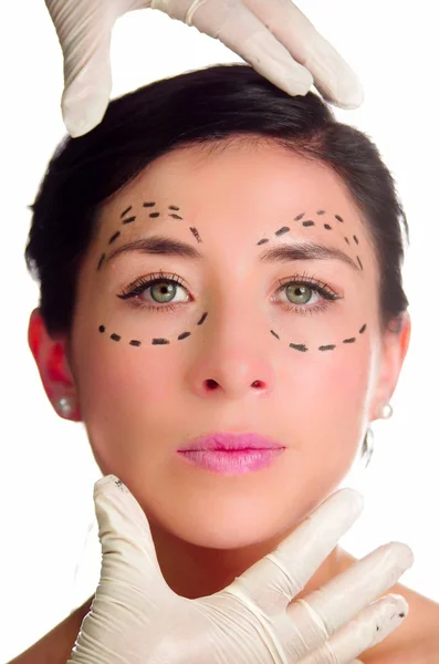 Headshot kaukaski kobieta oznaczonym kropkowaną linią rysowaną wokół oczy patrząc na kamery, lekarze ręce trzyma głowę, przygotowanie Chirurgia plastyczna — Zdjęcie stockowe