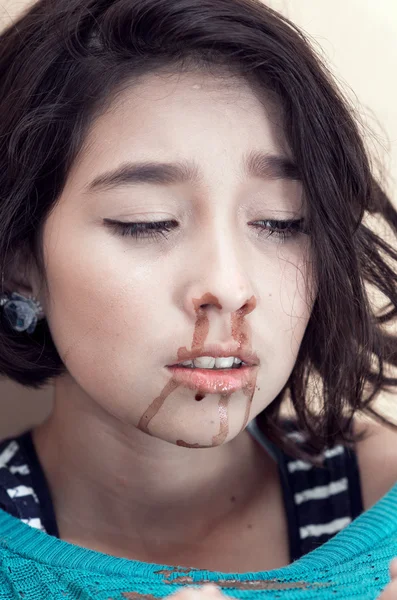 Young beautiful upset girl nosebleeding — Stock Photo, Image