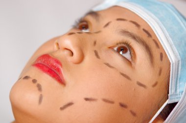 Portre genç kadının yüz cilt, kırmızı aracını kullanarak yukarıda da görüleceği gibi ölçme Doktor çizilmiş çizgiler ile kozmetik ameliyat için hazırlanıyor