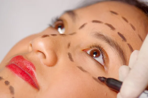 Närbild unga kvinnans ansikte förbereder sig för kosmetisk kirurgi med linjer dragna på huden, läkare mäta röd verktyget, som kan ses från ovan — Stockfoto