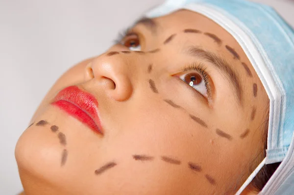Крупным планом молодая женщина готовится к косметической хирургии с линиями, нарисованными на коже, доктор измеряет красным инструментом, как видно сверху — стоковое фото