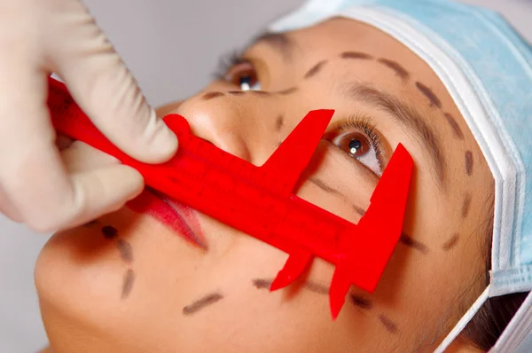 Closeup young womans face preparing for cosmetic surgery with lines drawn on skin, doctor measuring using red tool, as seen from above