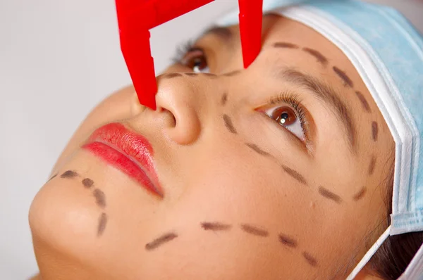 Крупным планом молодая женщина готовится к косметической хирургии с линиями, нарисованными на коже, доктор измеряет красным инструментом, как видно сверху — стоковое фото
