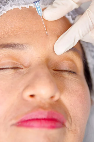 Primeros planos de las mujeres se enfrentan a recibir inyecciones antiarrugas con jeringa, concepto de cirugía estética, como se ve desde arriba —  Fotos de Stock