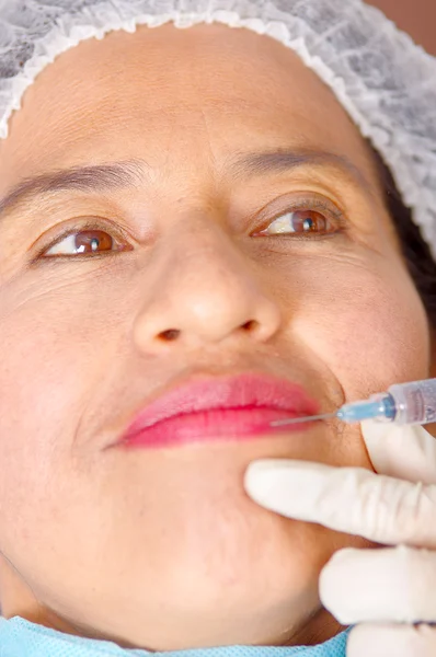 Primeros planos de las mujeres se enfrentan a recibir inyecciones antiarrugas con jeringa, concepto de cirugía estética, como se ve desde arriba —  Fotos de Stock