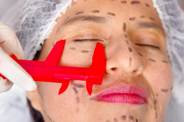 Closeup womans face preparing for cosmetic surgery with lines drawn on skin doctor measuring using tool, as seen from above — Stock Photo, Image
