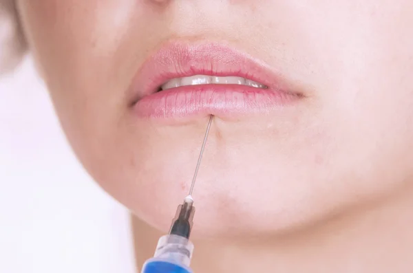 Primer plano de los labios recibiendo la inyección de botox — Foto de Stock