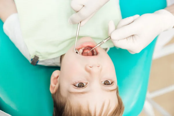 Niño con la boca abierta durante la inspección oral en la clínica dental — Foto de Stock