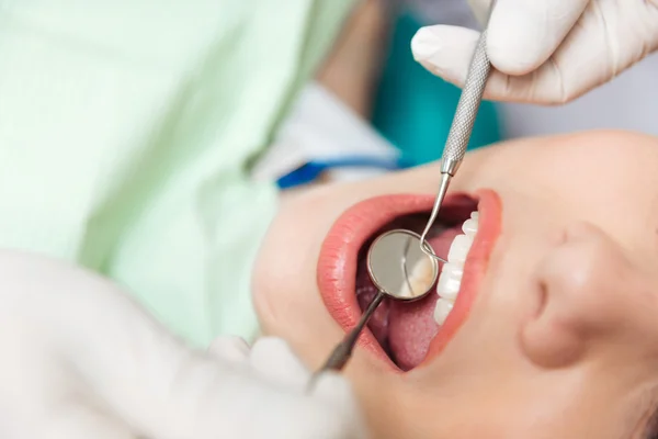 Close-up da boca aberta do doente durante a inspecção oral — Fotografia de Stock