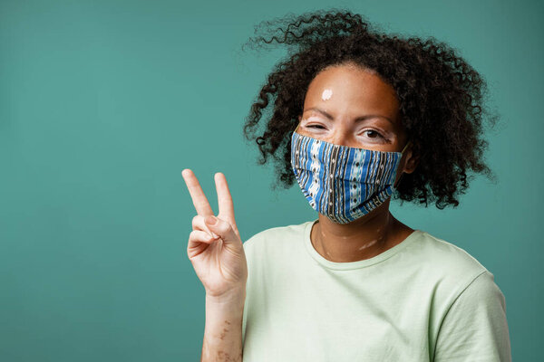Young Woman Vitiligo Wearing Face Mask Showing Peace Sign Isolated — Stock Photo, Image
