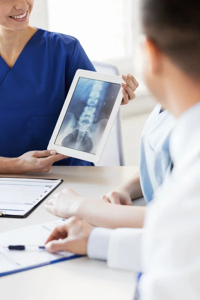 Perto de médicos felizes com raio-x no hospital — Fotografia de Stock
