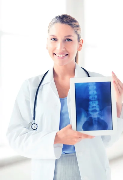 Médico femenino con rayos X en el comprimido pc — Foto de Stock