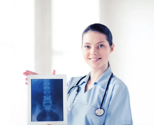 Médico femenino con rayos X en el comprimido pc — Foto de Stock