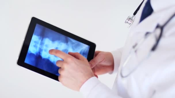 Arts werkzaam met x-ray scan op tablet pc — Stockvideo