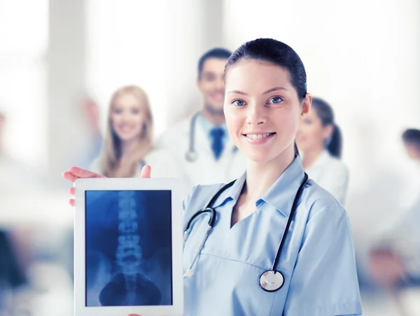 Female doctor with x-ray on tablet pc — Stock Photo, Image