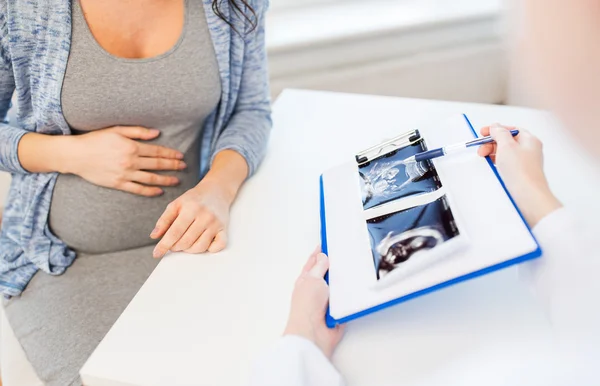 Gros plan du médecin et de la femme enceinte échographie — Photo