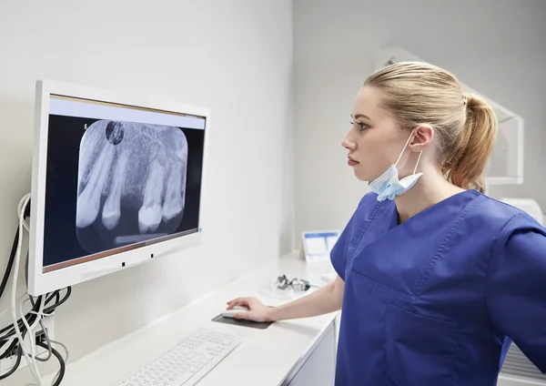 Dentista con rayos X en monitor en clínica dental — Foto de Stock