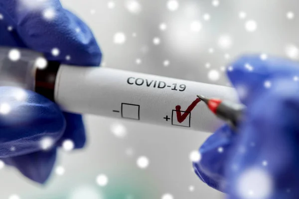 Kädessä pidettävä dekantterilasi koronaviruksen verikokeella — kuvapankkivalokuva