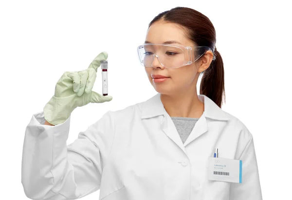 Asiatico femmina medico holding beaker con sangue test — Foto Stock