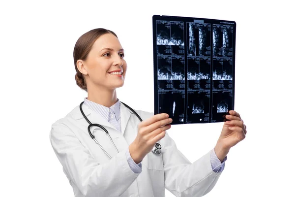 Счастливая улыбающаяся женщина-врач с рентгеном — стоковое фото