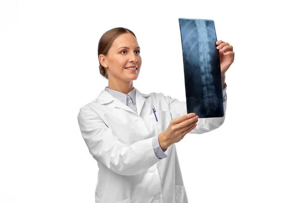 Feliz sonriente médico femenino con rayos X de columna vertebral — Foto de Stock