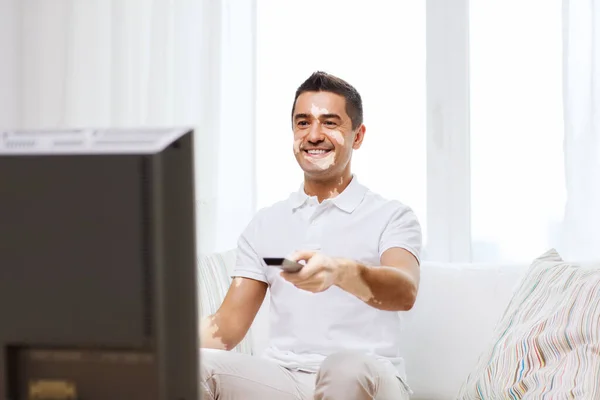 Улыбающийся мужчина средних лет с витилиго смотреть телевизор — стоковое фото
