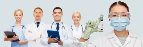 Asian female doctor holding beaker with blood test — Stock Photo, Image