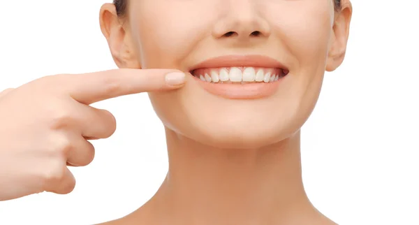 Beautiful woman pointing to teeth — Stock Photo, Image