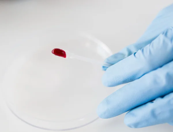 Primer plano del científico con muestra de sangre en el laboratorio —  Fotos de Stock