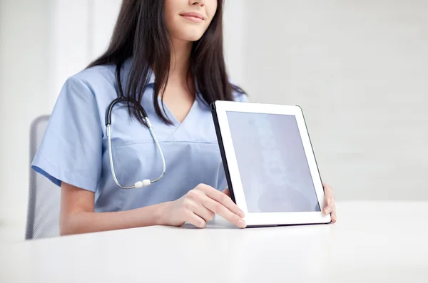 Läkare visar röntgen på TabletPC — Stockfoto