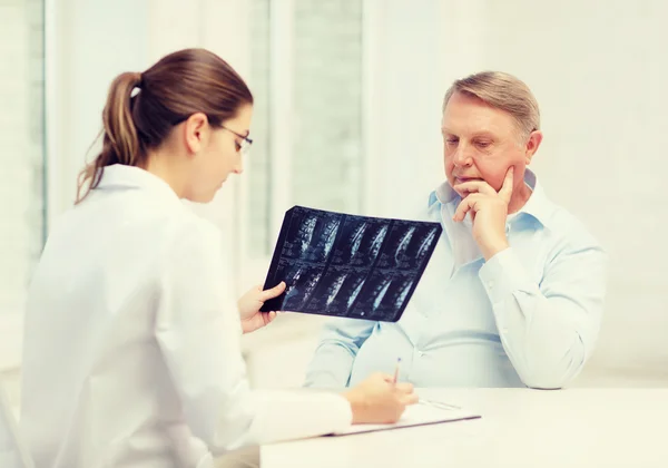 Female doctor with old man looking at x-ray — Stock Photo, Image