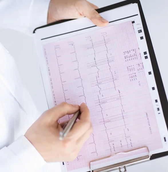 Male doctor hands with cardiogram — Stock Photo, Image