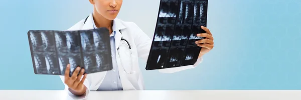 Mujer afroamericana que mira las radiografías — Foto de Stock