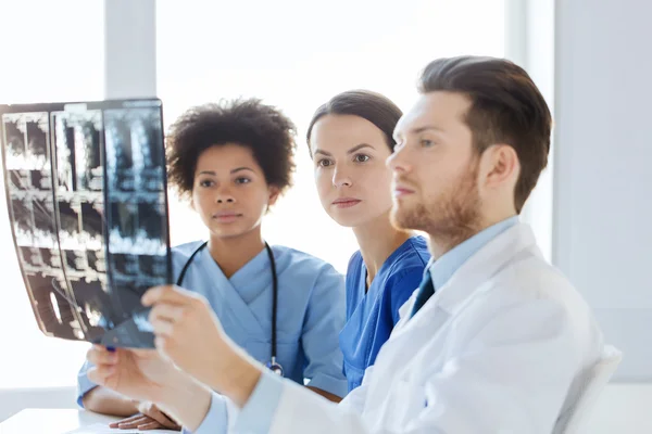Skupina lékařů při pohledu do rentgenu v nemocnici — Stock fotografie