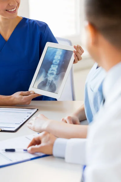 Close up of happy doctors with x-ray at hospital — Stock Photo, Image