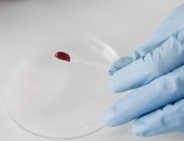 Primer plano del científico con muestra de sangre en el laboratorio —  Fotos de Stock