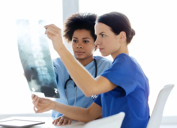 Doctors with x-ray image of spine at hospital Royalty Free Stock Photos