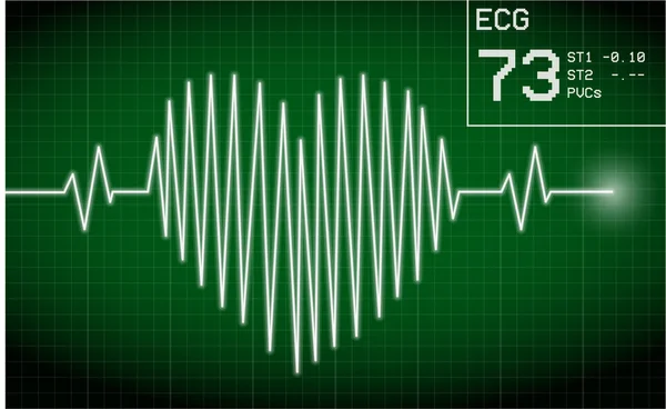 Heartbeat on display — Stock Vector