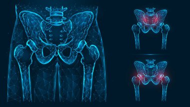 Leğen kemiği ve kalça kemiği, insan anatomisi. Pelvik ve kalça yaralanmaları. Mavi arkaplanda izole edilmiş çizgi ve noktalardan oluşan kalça eklemlerinin röntgeni.