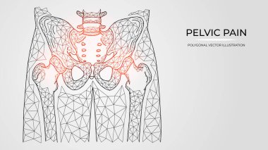 Polygonal vector illustration of pain, inflammation or injury in the pelvis and hip joint. Medical orthopedic diseases templates clipart