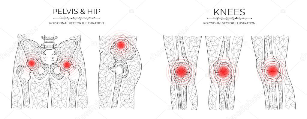Polygonal vector illustration of pelvic and knee pain. Medical orthopedic diseases templates
