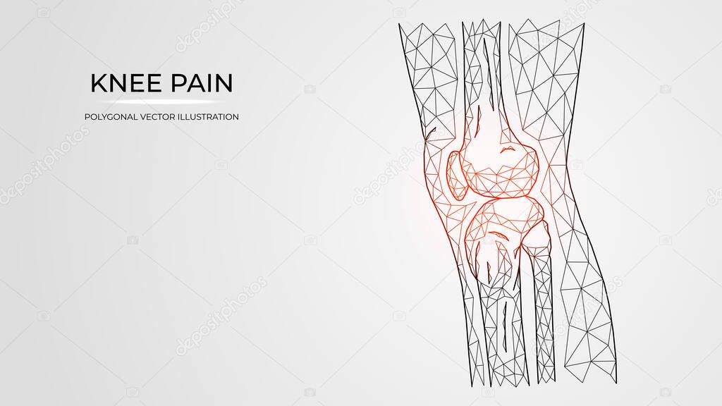 Polygonal vector illustration of pain, inflammation or injury in the knee side view. Human leg bones anatomy. Medical orthopedic diseases templates