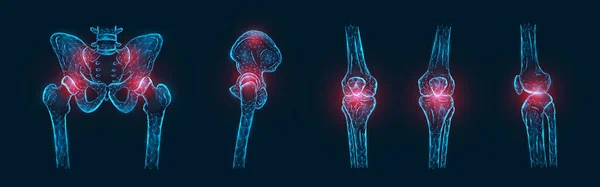 股関節 膝関節の骨の痛みや炎症の多角形のベクトル図が単離された 関節痛の概念 — ストックベクタ