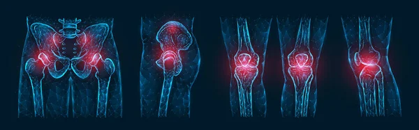 多角形矢量表示骨盆 髋关节和膝关节的疼痛或发炎 在深蓝色背景下孤立 骨科疾病医疗模板 — 图库矢量图片