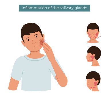 Vector flat illustration of a person with inflamed salivary glands. The guy feels pain in the salivary gland. clipart