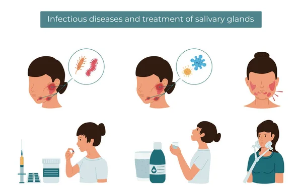 Ilustração Vetorial Plana Doenças Infecciosas Tratamento Glândula Salivar — Vetor de Stock