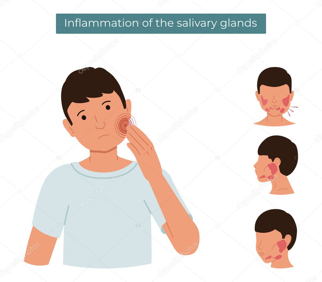 Vector flat illustration of a person with inflamed salivary glands. The guy feels pain in the salivary gland.