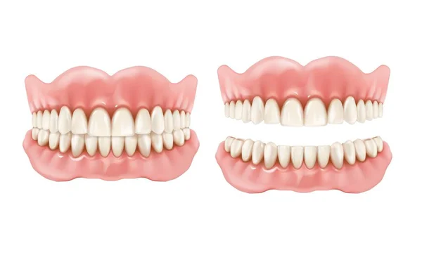 Dentadura Dentes Mandíbula Dentária Prótese Realista Dente Vetorial Boca Mockup —  Vetores de Stock