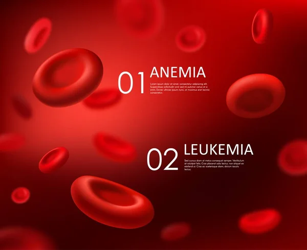Анемія Лейкемія Векторні Захворювання Крові Еритроцитами Червоних Клітин Медицина Охорони — стоковий вектор