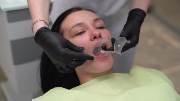 Joven hermosa dama caucásica en la cita del dentista. el dentista instala un retractor labial al paciente. — Vídeo de stock